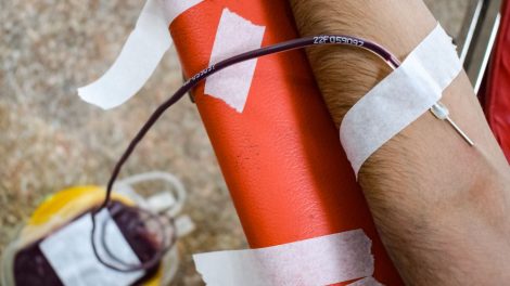 Braço de uma pessoa durante doação de sangue, com agulha inserida e bolsa coletora visível.