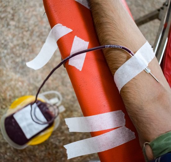 Braço de uma pessoa durante doação de sangue, com agulha inserida e bolsa coletora visível.